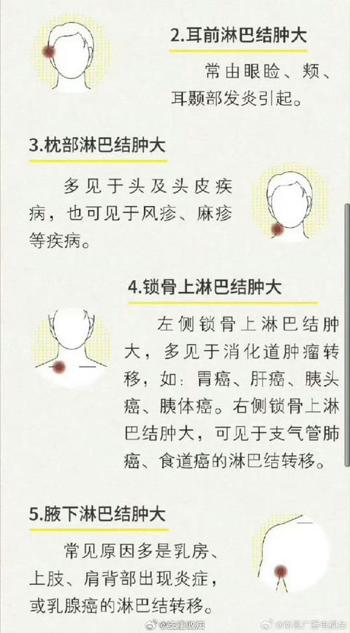 装修淋巴肿,介绍装修后淋巴肿大之谜，为健康保驾护航 装修淋巴肿,介绍装修后淋巴肿大之谜，为健康保驾护航 买房须知